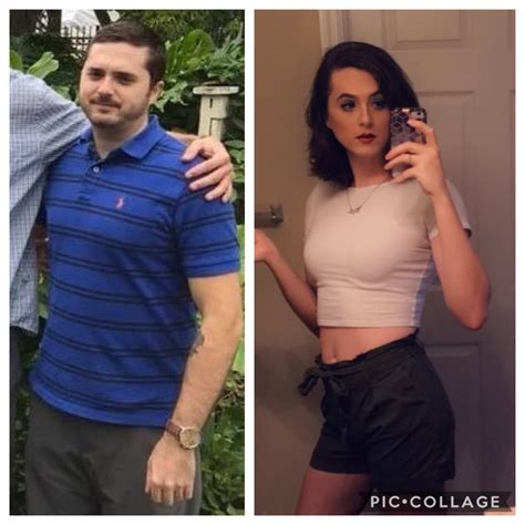 31 mtf 18 months hrt this week 2 year difference between pics r transtimelines