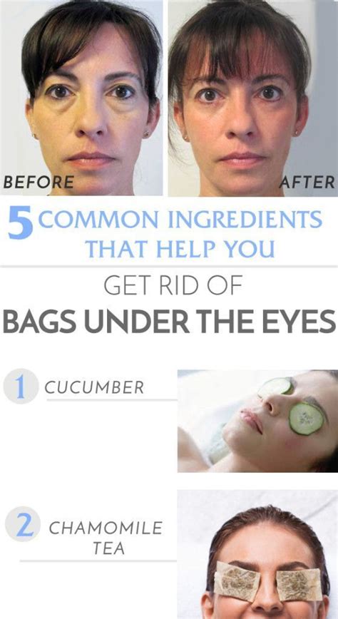 How To Get Rid Of Under The Eye Bags At Home Eyebagsbakingsoda Eye