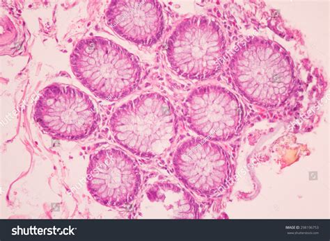Cross Section Of The Human Tissue In The Microscope Viewmedical
