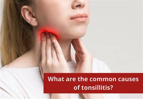 Tonsillitis Symptoms Causes Risk Factors And Treatments