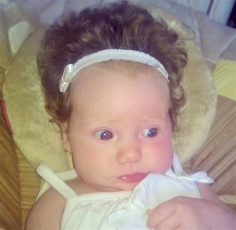 Viral Birth Photos Show Beautiful Stunning Conehead Baby Phenomenon