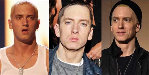Eminem Plastic Surgery Before And After Pictures 2020