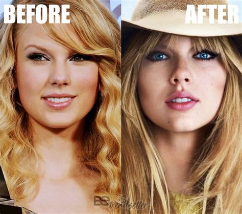 Taylor Swift Plastic Surgery Before And After Nose Job Boob Job Yo Images And Photos Finder