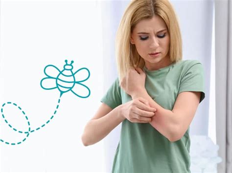 3 Steps To Prevent Bee Sting Allergic Reactions Sponsored