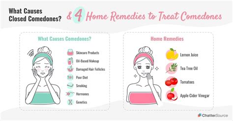 How To Treat Closed Comedones Chattersource