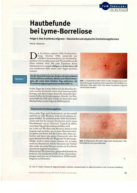 Pdf Skin Manifestations In Lyme Borreliosis 2 Erythema Migrans