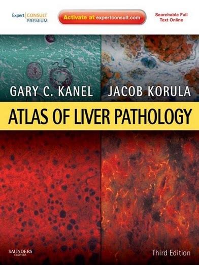 Atlas Of Liver Pathology 3rd Edition Expert Consult Online And Print