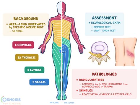 Dermatomes What Are They Related Diseases And More Osmosis Dermatomes Chart And Map