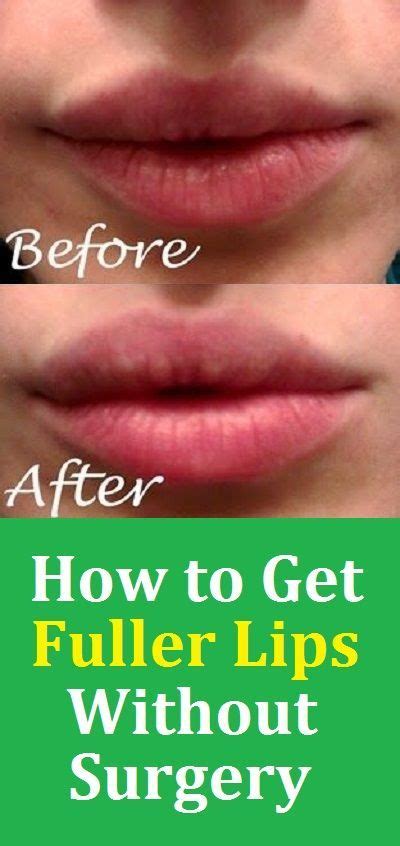 How To Get Fuller Lips Without Surgery In 2020 Lips Fuller Fuller