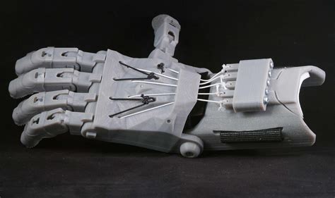 Upper Limb Prosthetics Enabling The Future