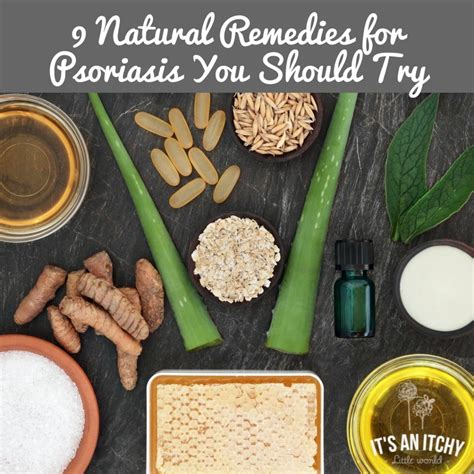 9 Natural Remedies For Psoriasis You Should Try Its An Itchy Little