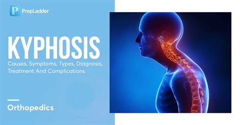 Kyphosis Causes Symptoms Types Diagnosis Treatment And Complications