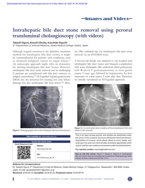 Pdf Intrahepatic Bile Duct Stone Removal Using Peroral Transluminal