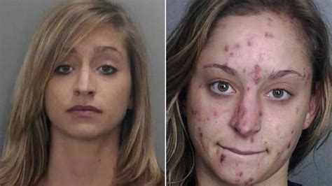 el impactante y desagradable efecto de la droga en el rostro de los adictos infobae