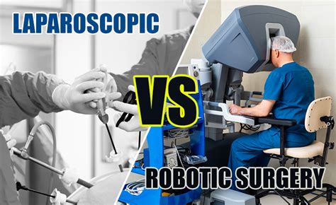 Laparoscopic Vs Robotic Surgery In Urology Chennai Robotic Surgery