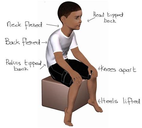 Joint Hypermobility In Children What Is It And How It Affects Fitness