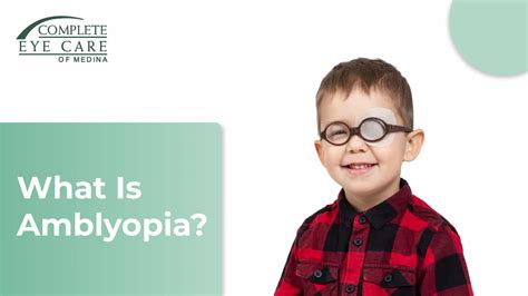 What Is Amblyopia Lazy Eye Complete Eye Care Of Medina