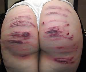 Naughty Bottoms Are Caned Spanked And Flogged Fetish Porn Pic