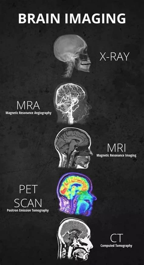 Brain Imaging Types Medical School Essentials Brain Images Medical