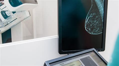 3d Mammography For Detecting Breast Cancer Sharp Healthcare