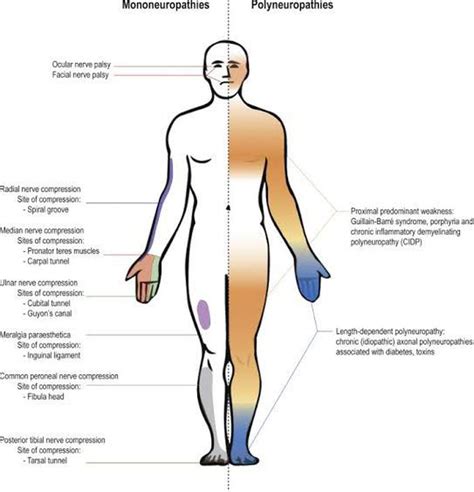 Peripheral Neuropathies At A Glance Medizzy