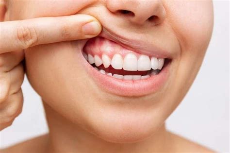 How To Keep Your Gums Healthy Periodontal Disease Prevention And