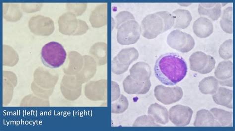 Veterinary Hematology Dextervet Lymphocyte