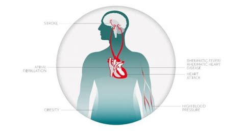 14 Hidden Risks That Increase Your Chance For A Heart Attack And How