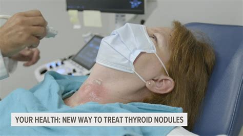 A New Non Invasive Way To Treat Thyroid Nodules