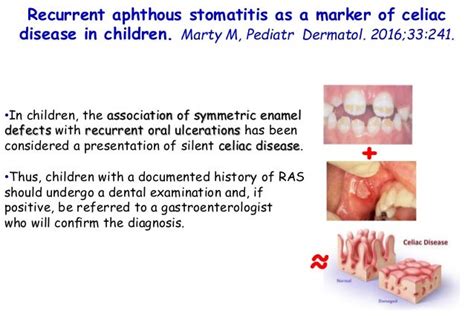 Oral Mucosal Disease Recurrent Aphthous Stomatitis