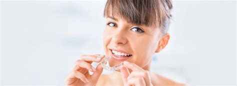 Top 5 Advantages Of Invisalign Over Traditional Braces