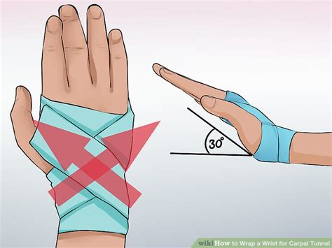 3 Ways To Wrap A Wrist For Carpal Tunnel Wikihow
