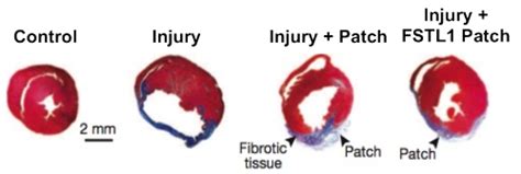 «η κολχικίνη μειώνει την θνητότητα, αλλά δεν είναι πανάκεια», αναφέρει ο πρόεδρος της ελληνικής εταιρείας λοιμώξεων π.γαργαλιάνος, ενώ για ένα φθηνό και διαθέσιμο φάρμακο φυτικής προέλευσης. Η ΑΝΤΙΦΛΕΓΜΟΝΩΔΗΣ ΚΟΛΧΙΚΙΝΗ ΦΑΙΝΕΤΑΙ ΟΤΙ ΘΑ ΓΙΝΕΙ ...