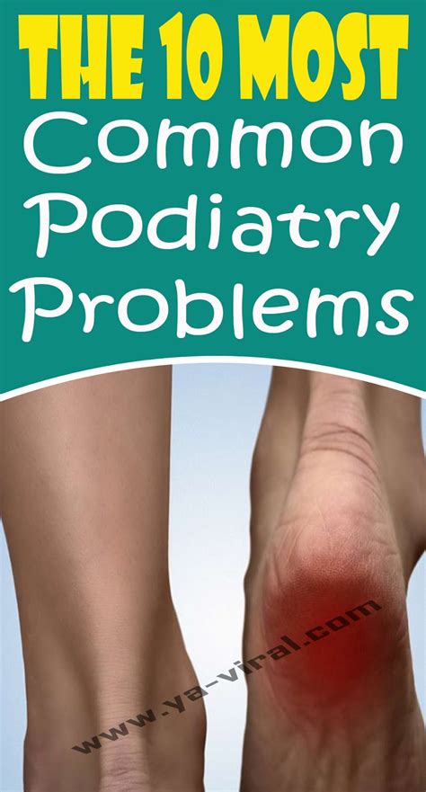 The 10 Most Common Podiatry Problems Xavidream