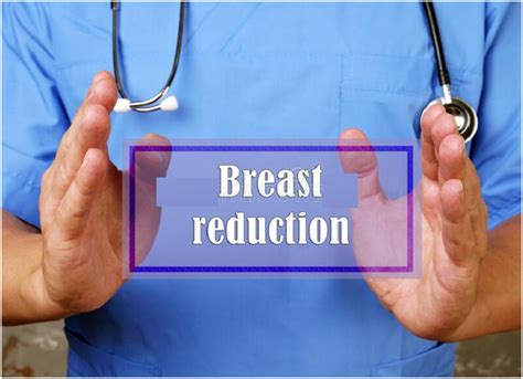 Breast Reduction Surgery Things To Consider Mylargebox