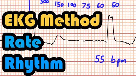 Method Rate Rhythm How To Read An Ekg Curriculum Youtube