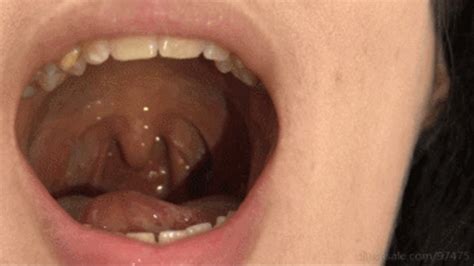 My Uvula First Uvula And Tonsils Video Sd Version Miss M Dirty World