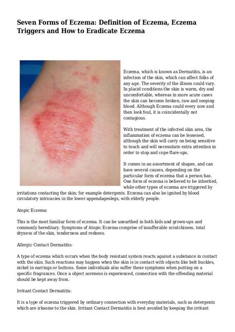 Seven Forms Of Eczema Definition Of Eczema Eczema Triggers And How To