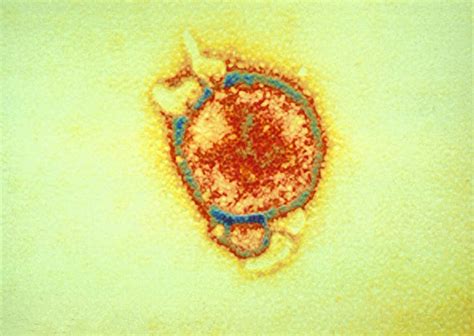 How We Developed The Hendra Virus Vaccine For Horses