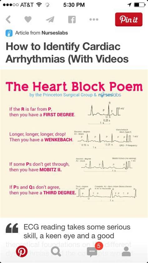 The Heart Block Poem Heart Block Poem Heart Blocks Nursing School