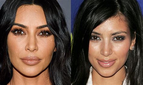 Kim Kardashian Again Insists She Has Never Had A Nose Job Daily Mail