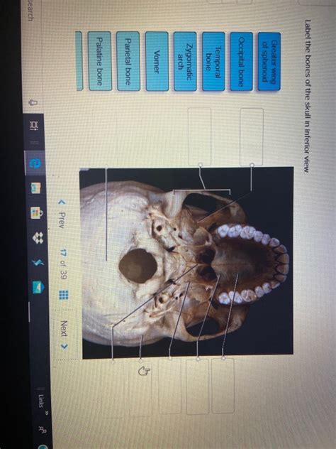 Solved Label The Bones Of The Skull In Inferior View