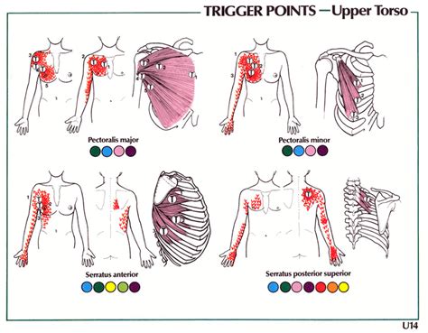 Trigger Point Pain Referral Chart