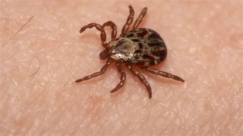 Georgia Woman Allergic To Meat Dairy Soap Following Tick Bite
