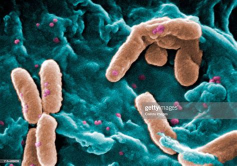 Sem Of Pseudomonas Aeruginosa Bacteria High Res Stock Photo Getty Images