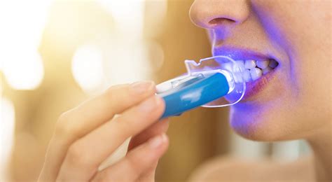 How Blue Light Teeth Whitening Works