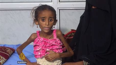 ‘nearly 600 Cholera Deaths In Yemen Over Past Month Health News Al Jazeera