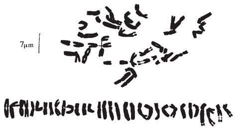 Karyotype And Karyogram Of Oxytropis Kozhuharovii From The Type