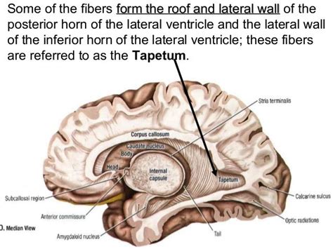 Tapetum In Brain Yahoo Image Search Results Brain Images Medical Anatomy Corpus Callosum