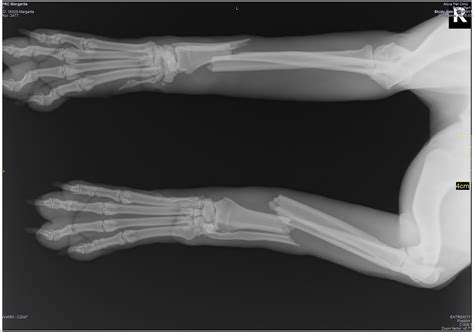 Cat X Ray Cost Leg Cat Meme Stock Pictures And Photos